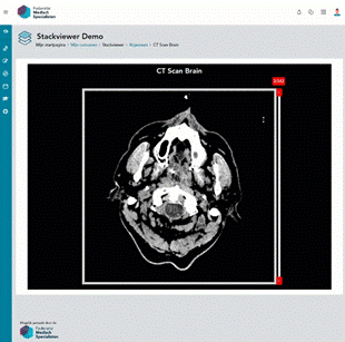 Stackviewer plugin